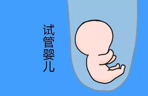 关于极光